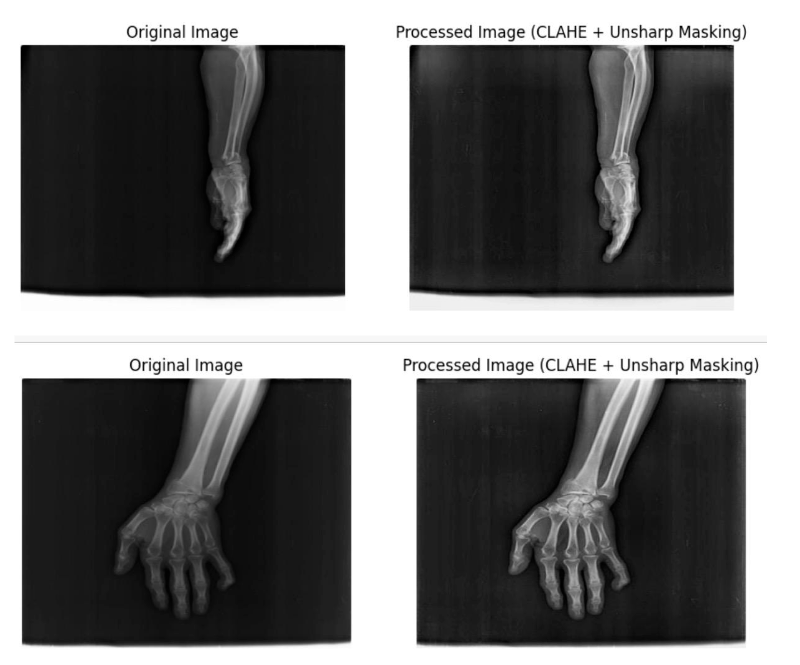 CLAHE and USM preprocessing techniques