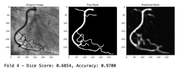 image segmentation and edge artifacts