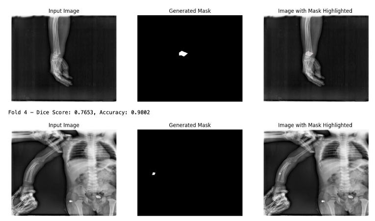 x-ray image with generated mask