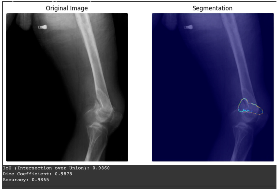 SegGPT in xray images