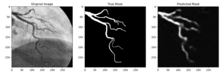 blood vessels imaging SE RegUNet