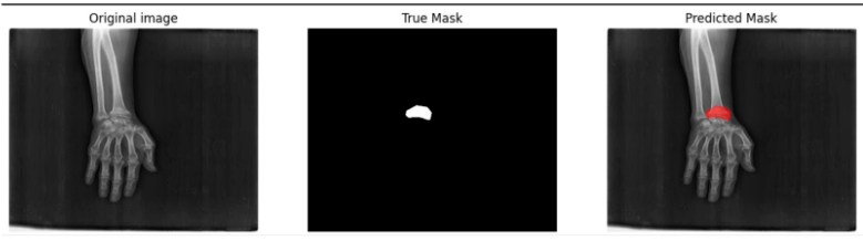 bone imaging CIDN