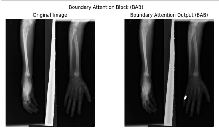 boundary attention block