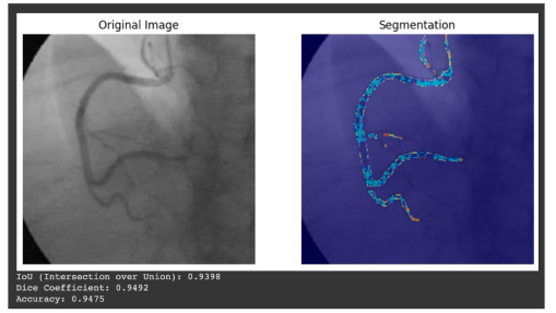 image segmentation